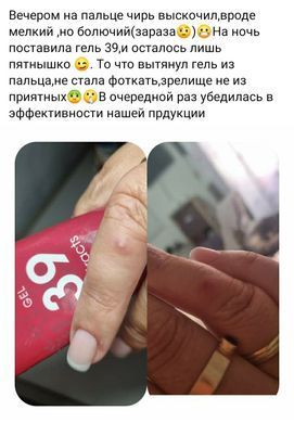 Гель універсальний крем Нове життя - 39 екстрактів 50мл New life Gel 39 extracts (інтенсивно оздоровлює шкіру, знімає подразнення і виявляє протизапальні і регенеруючі властивості)